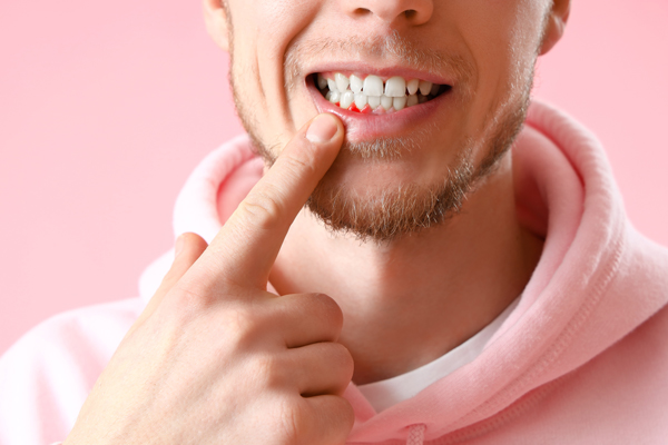 Go To A Periodontist For Dental Implants
